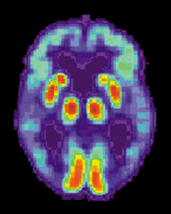 Imagen en color de un corte transversal del cerebro obtenida mediante una técnica de imagen médica.